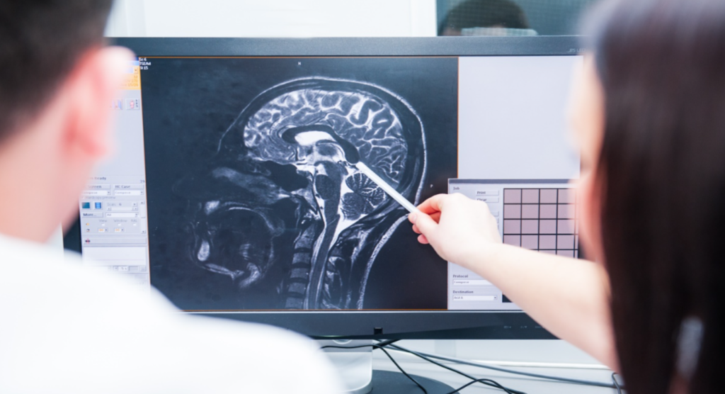 Diagnosing and Treating Brain Injury afteran Accident