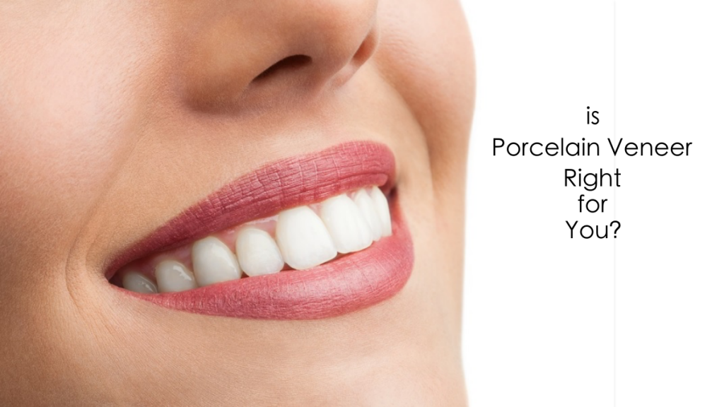 Is Porcelain Veneer Right for You?