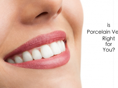 Is Porcelain Veneer Right for You?