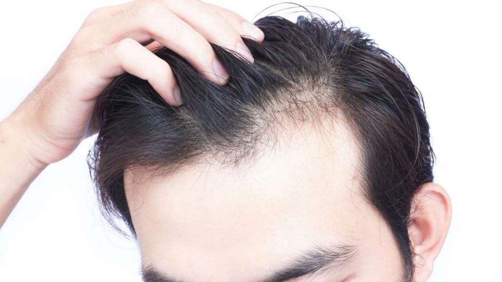 How to Prevent Hair Loss and Shedding