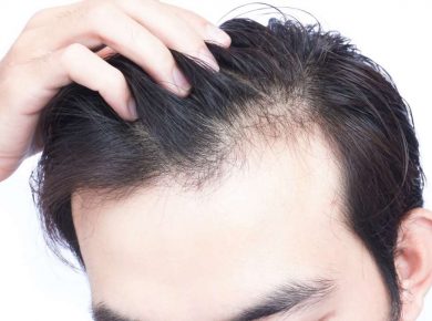 How to Prevent Hair Loss and Shedding