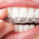 Care and Cleaning of your Invisalign Trays