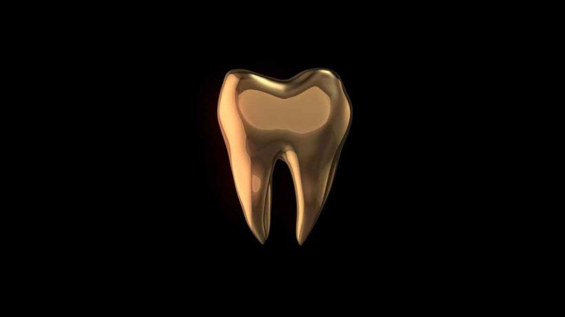 6 Tips for Buying and Selling Dental Gold