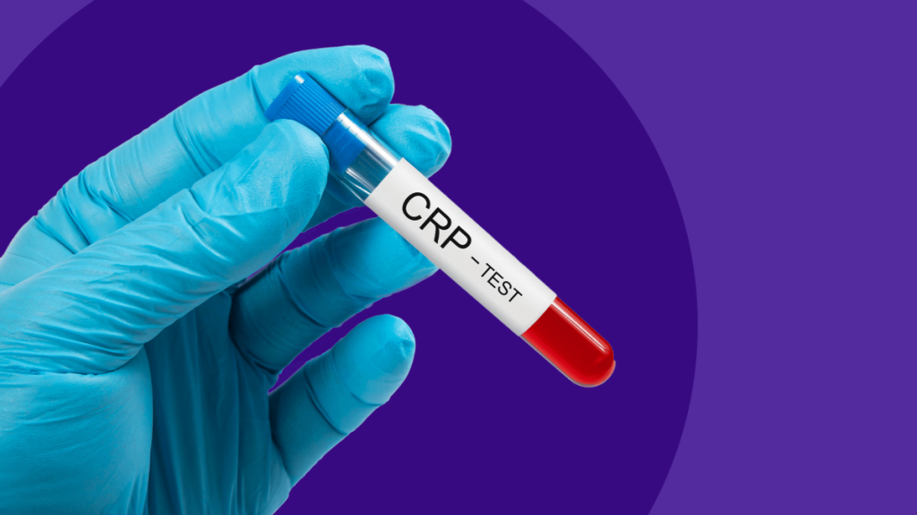 Why CRP Testing is Essential for Your Health