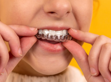 5 Crucial Reasons to Wear a Sports Mouthguard