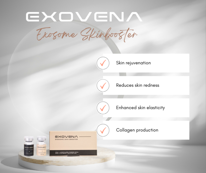 EXOVENA