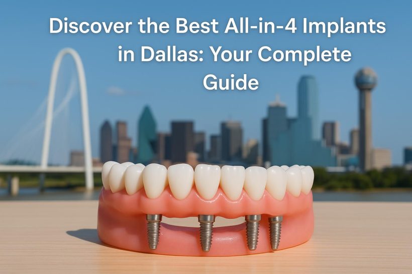 Dental implants and jaw model showcasing All-in-4 implant procedure in Dallas dental clinic
